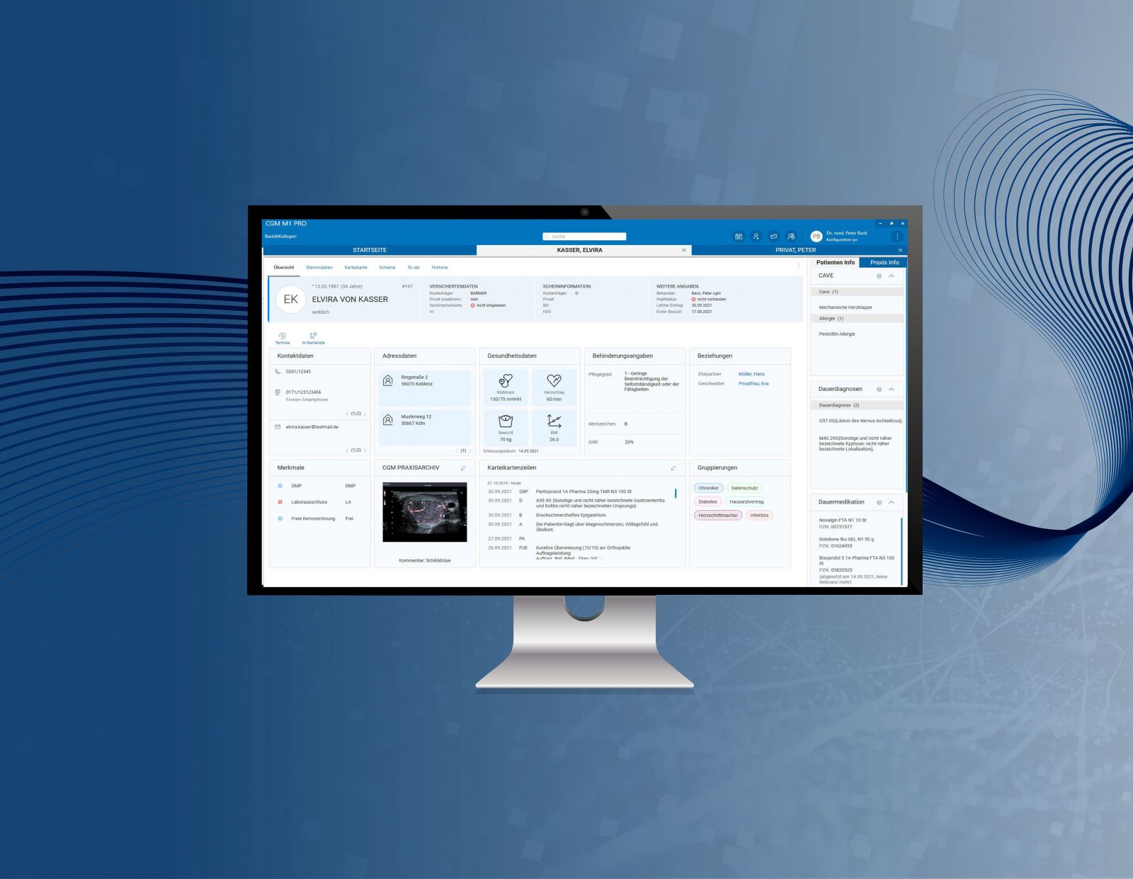 CGM M1 PRO Produktabbildung